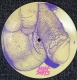 MEAT SHITS - Picture 7'' EP - Genital Infection